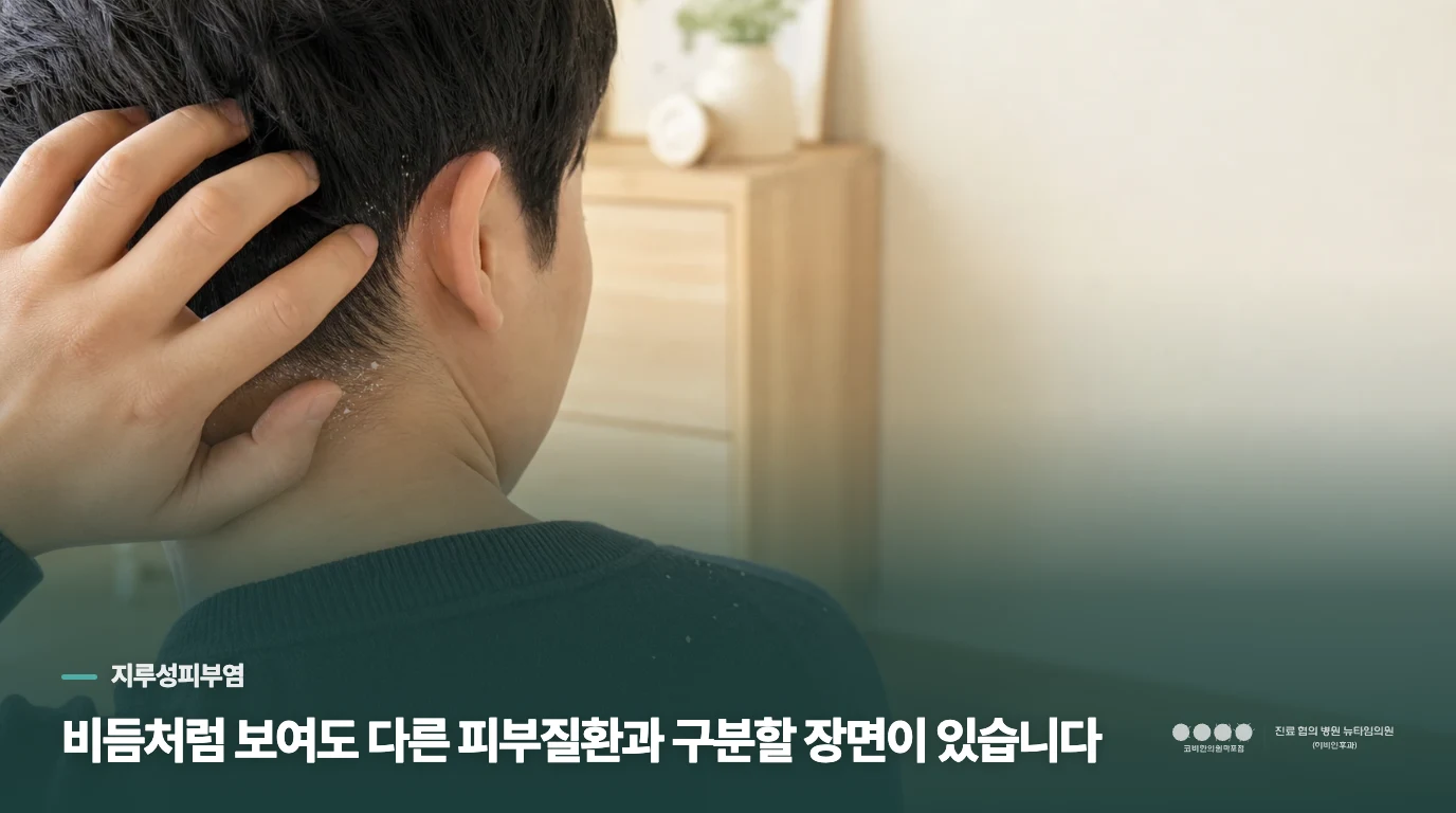 비듬처럼 보여도 다른 피부질환과 구분할 장면이 있습니다
