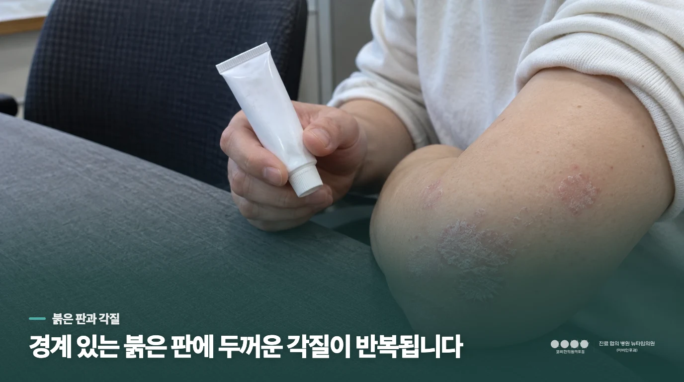 건선 각질은 단순히 피부가 마른 모습과 어떻게 다를까요?