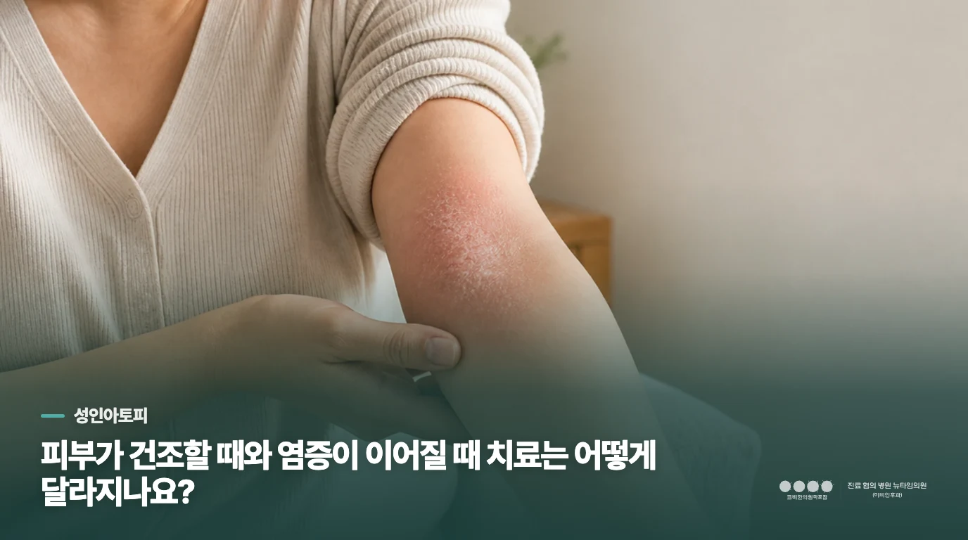 피부가 건조할 때와 염증이 이어질 때 치료는 어떻게 달라지나요?