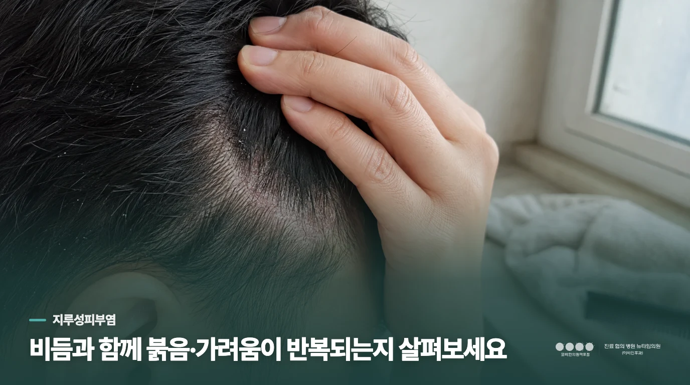 비듬과 함께 붉음·가려움이 반복되는지 살펴보세요