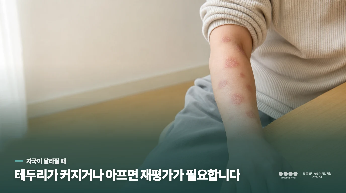 자국의 테두리가 커지거나 통증이 생길 때