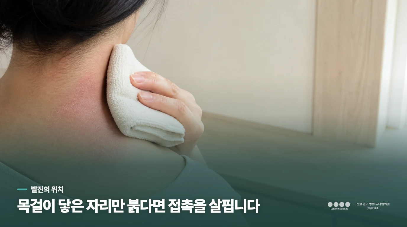 목걸이 모양대로 붉어졌다면 닿은 물질부터 살핍니다