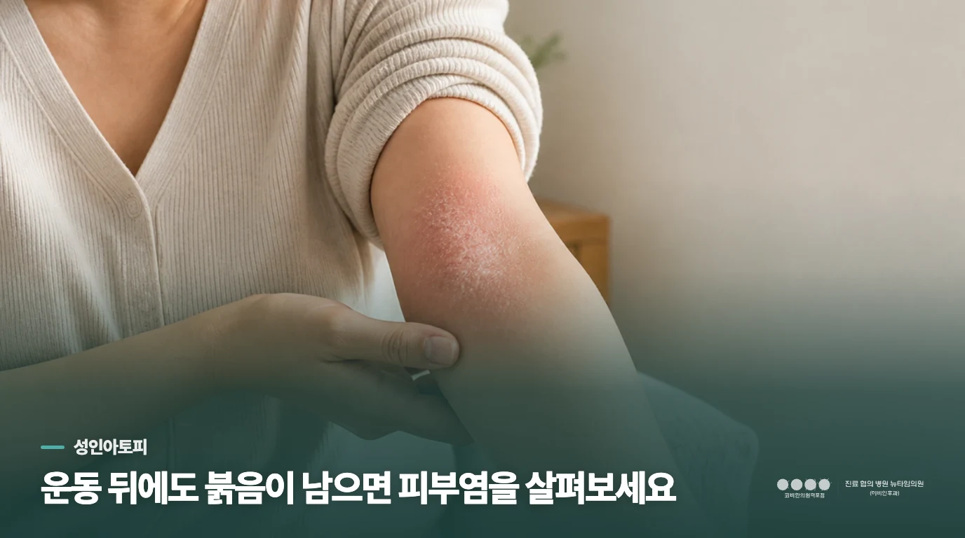 운동 뒤에도 붉음이 남으면 피부염을 살펴보세요