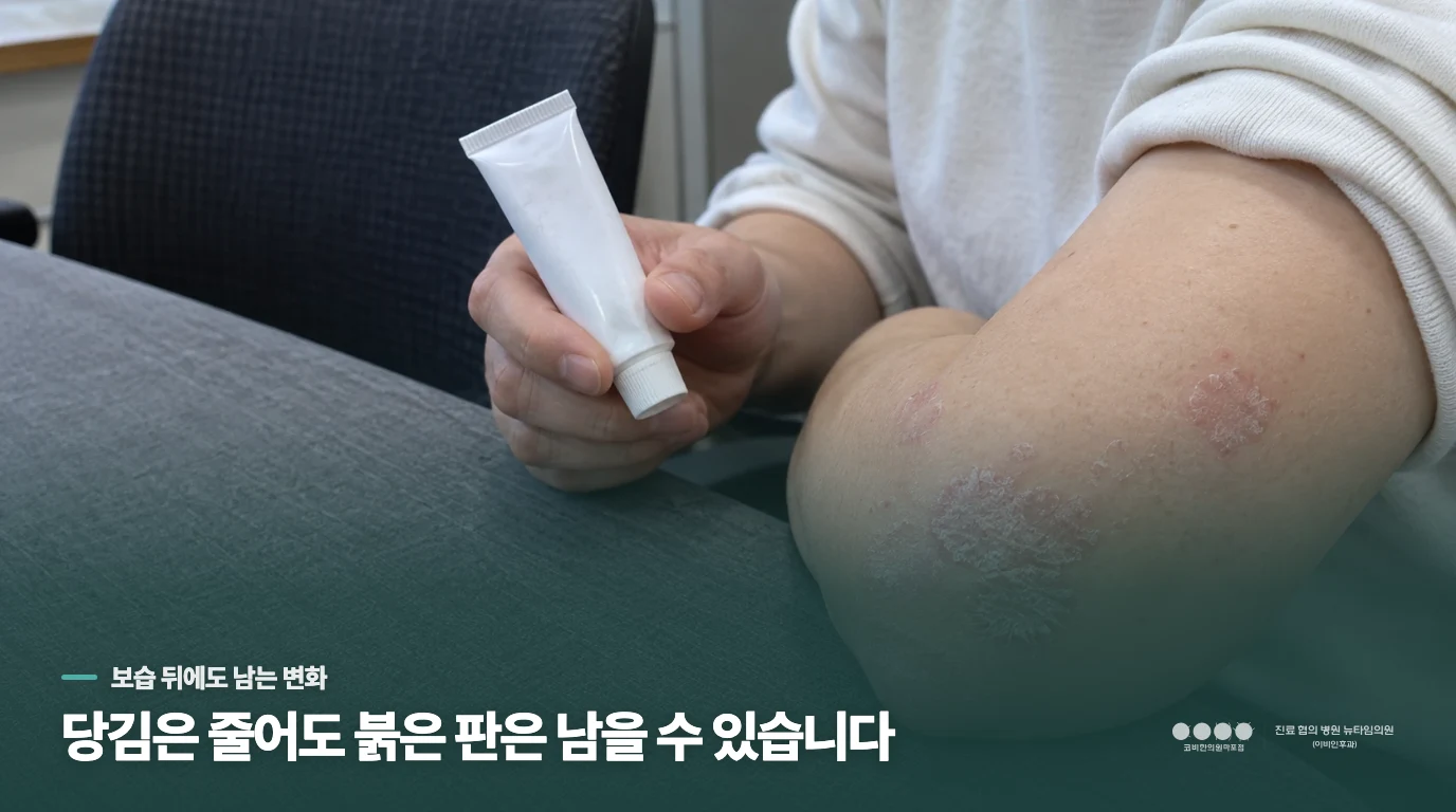 보습을 했는데도 같은 자리에 각질이 다시 쌓인다면