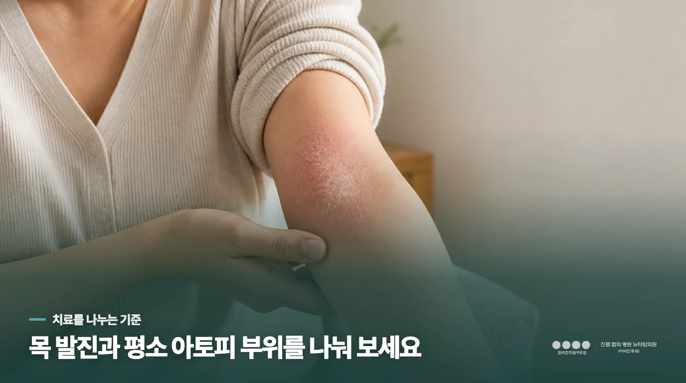 평소 아토피 부위까지 거칠어지면 치료 판단이 달라집니다