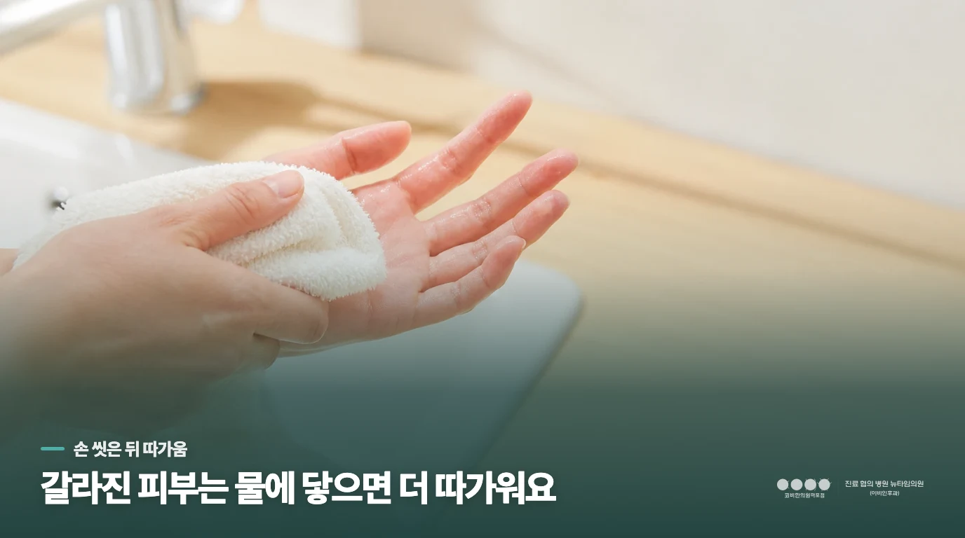 손을 씻은 뒤 더 따가운 이유