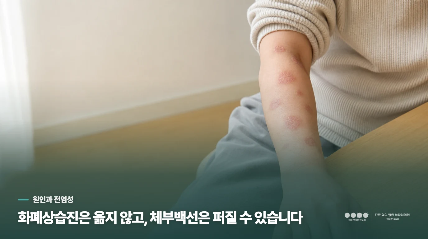 동그란 반점이 생기면 화폐상습진과 체부백선을 함께 떠올리는 이유