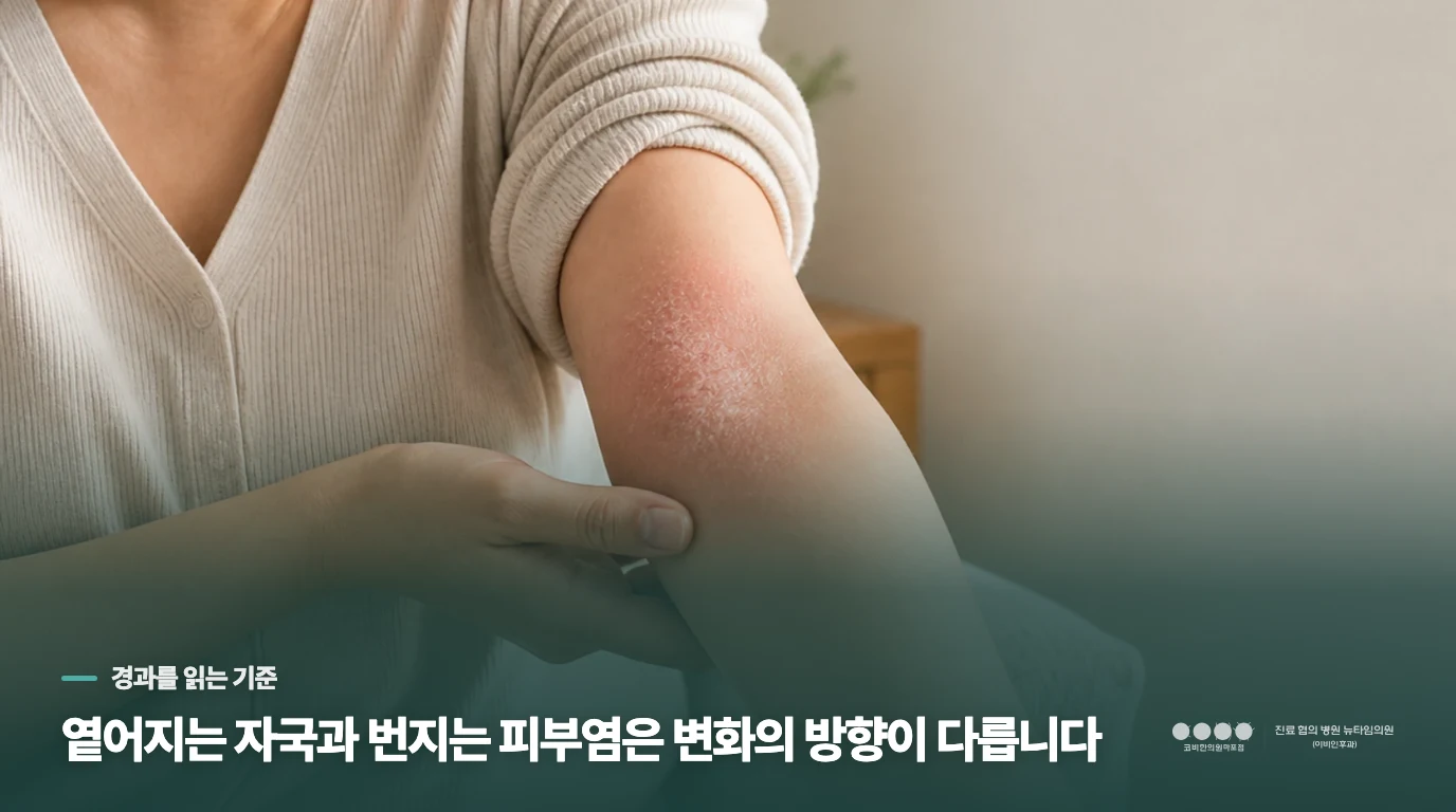 자국이 옅어지는지, 가려운 면적이 커지는지 보세요