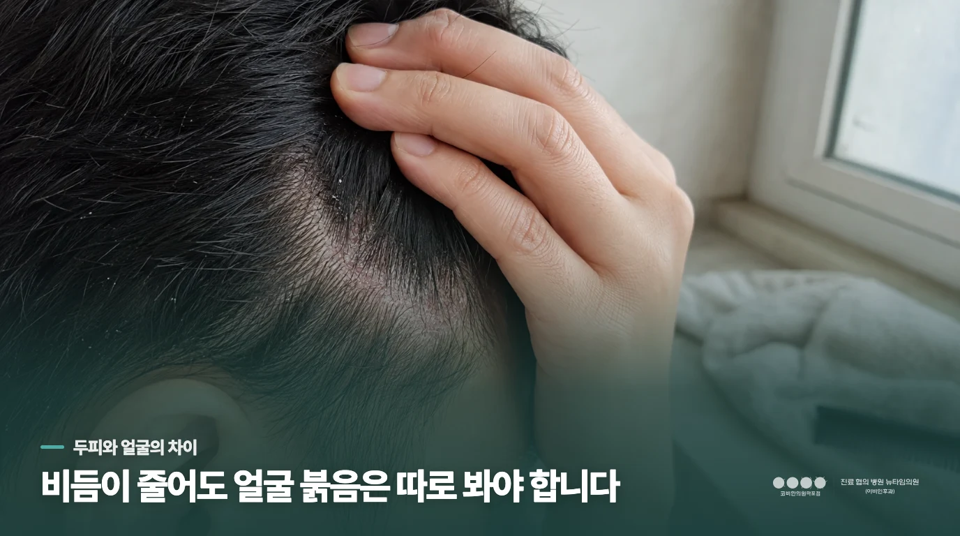 샴푸 뒤 비듬은 줄었는데 코 옆은 그대로라면
