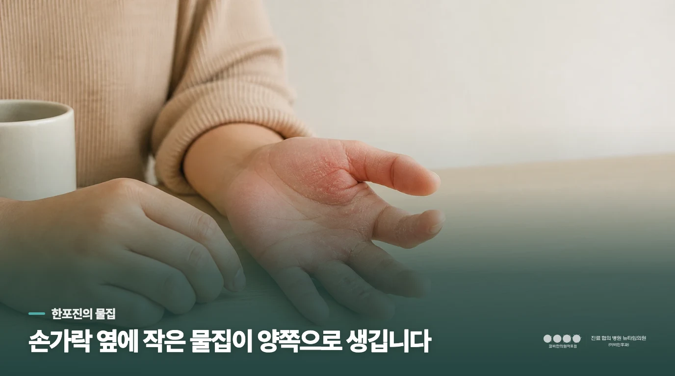 손가락 옆 작은 물집은 한포진에서 어떻게 나타날까요?