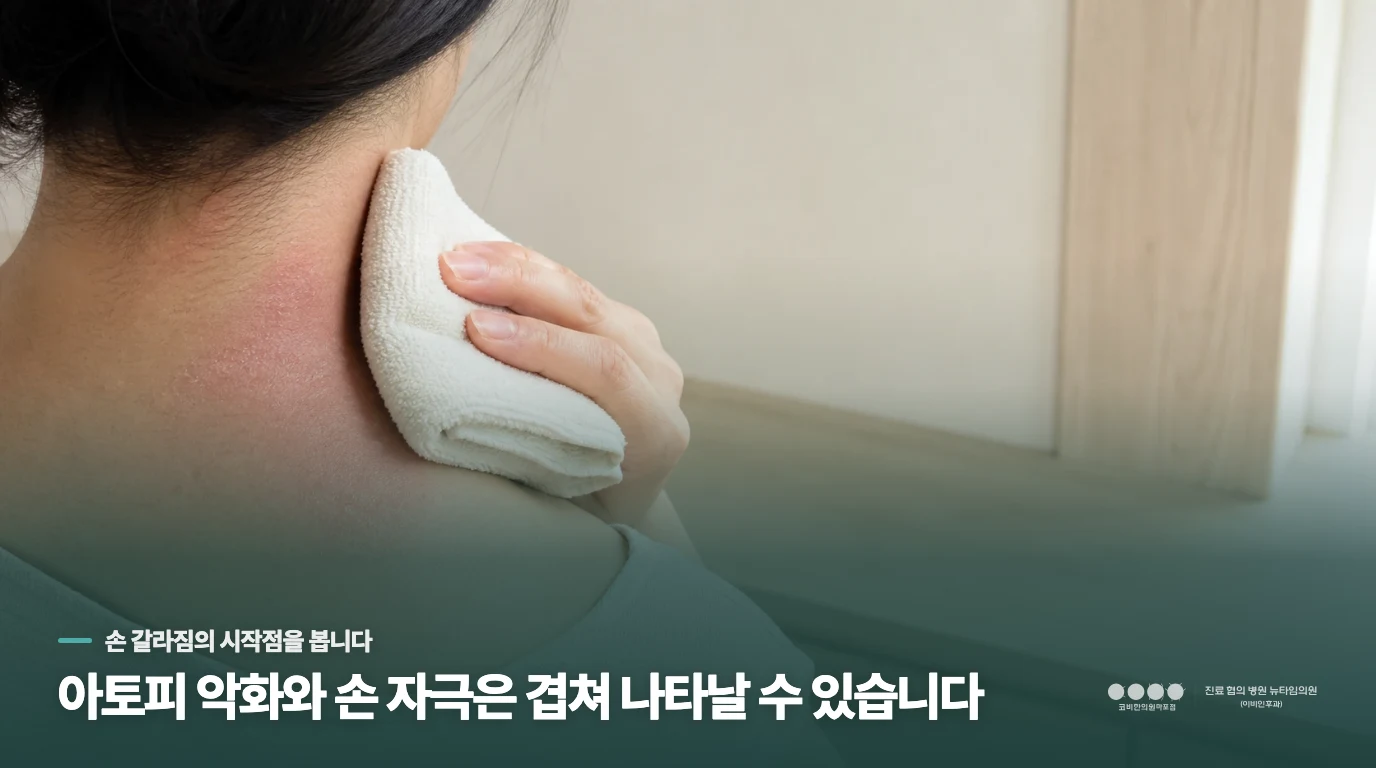 손가락이 갈라졌다고 모두 성인아토피 악화는 아닙니다