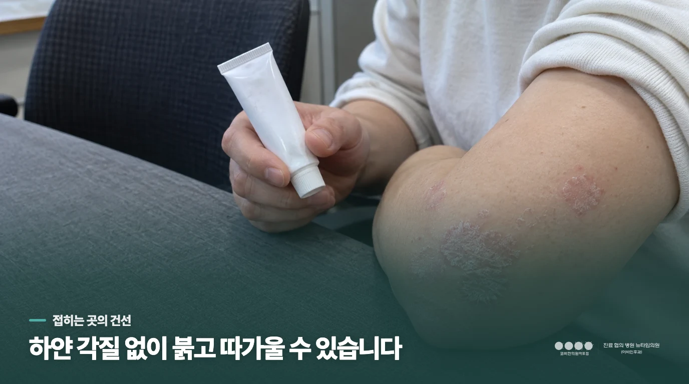 각질은 안 보이는데 옷이 스칠 때마다 따갑다면